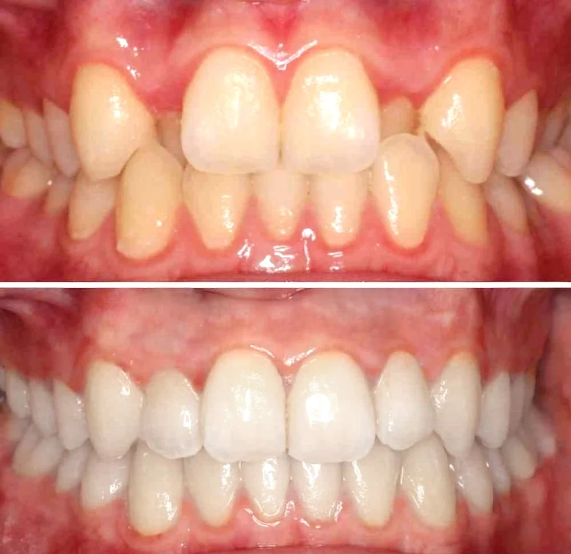 orthodontist dubai