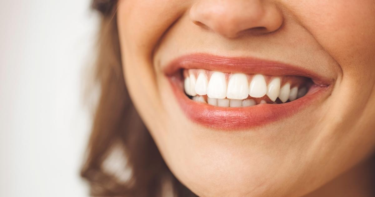 Dental Bridges_ Bridging the Gap in Your Smile