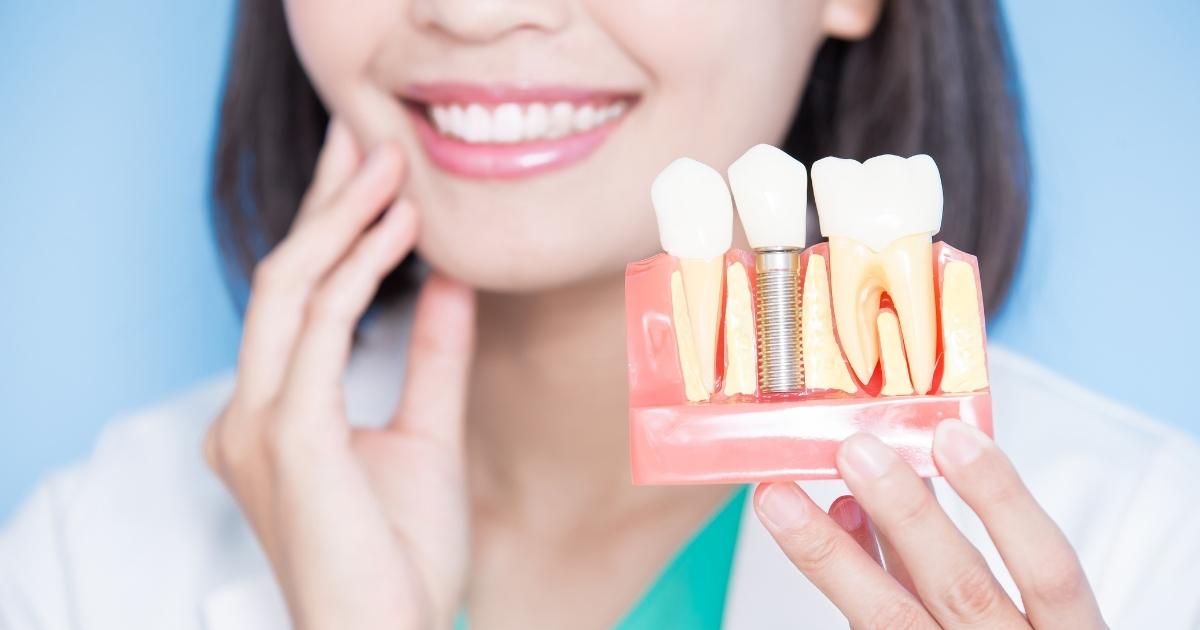 How do Dental Implants Differ from Natural Teeth When It Comes to Eating
