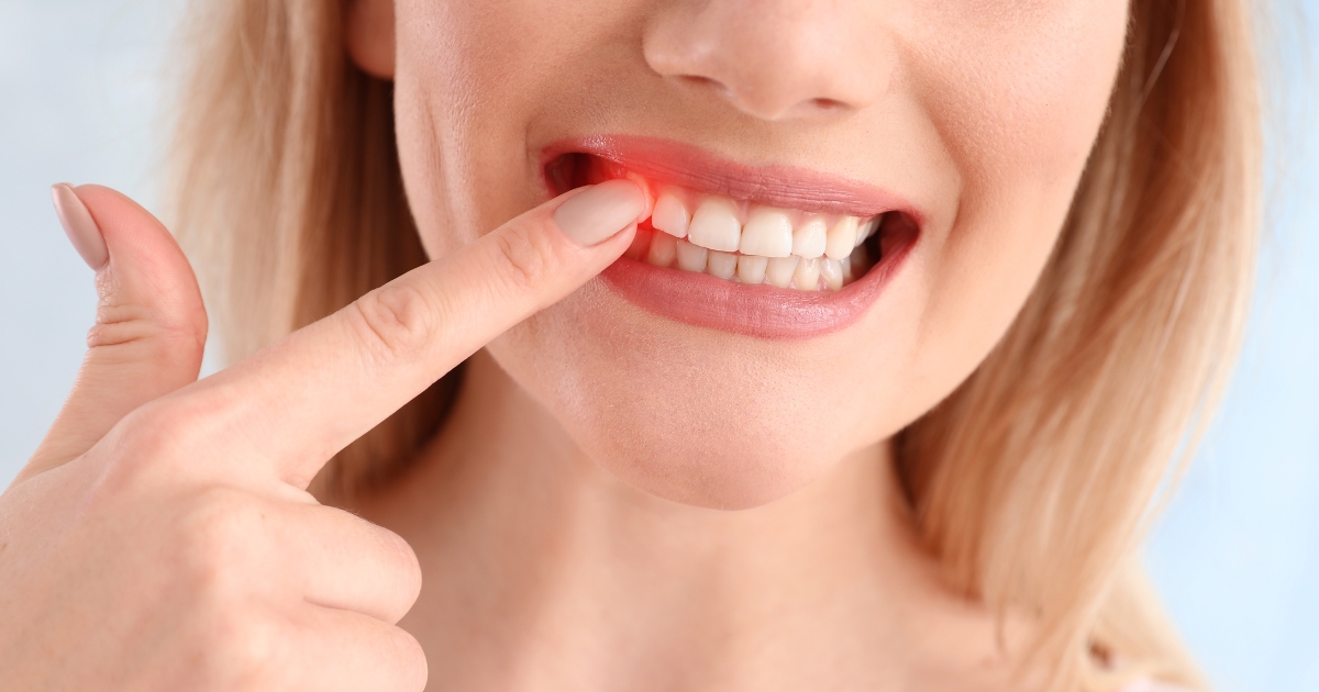 The Link Between Periodontal Disease and Other Health Conditions