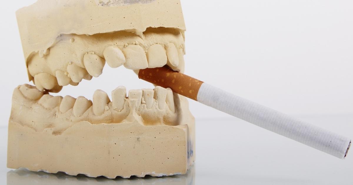 Why Smoking is a Major Concern for Dental Implant Surgery
